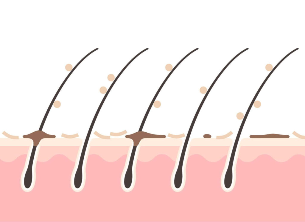 毛根鞘と皮脂の違い