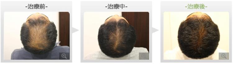 症例