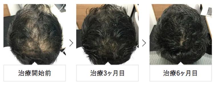 症例