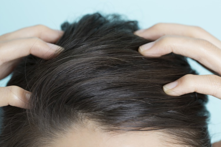 ストレスによる抜け毛を防ぐ5つの対策