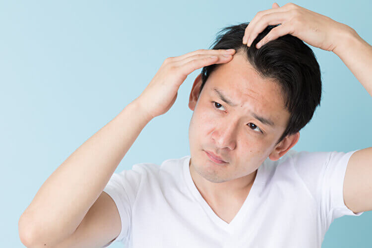 男性型脱毛症(AGA)|成人男性の多くに見られる症状