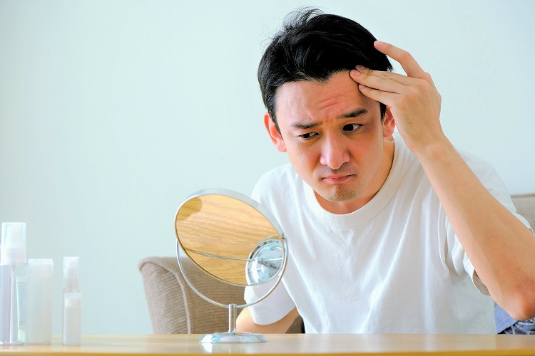 AGAが進行している男性の画像